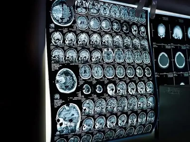 İstanbul'da 81 Binden Fazla Kişiye Ücretsiz Kanser Taraması Yapıldı!