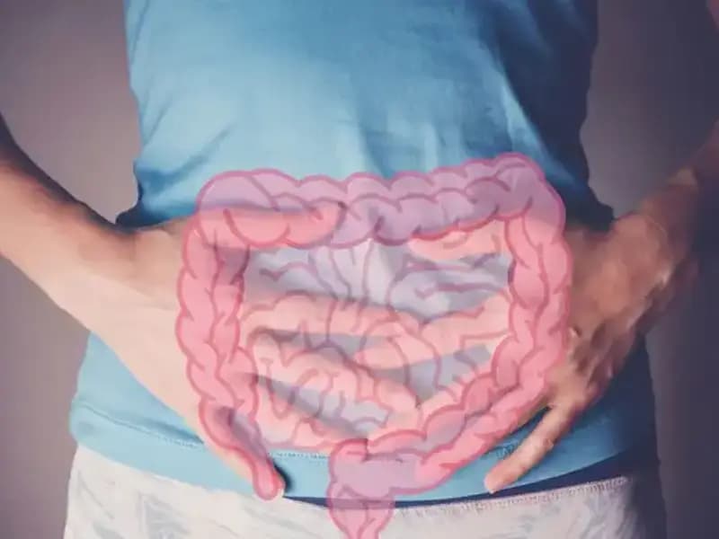 Gençlerde İleri Evre Kolon Kanseri: Nedenleri ve Uzmanların Tespitleri